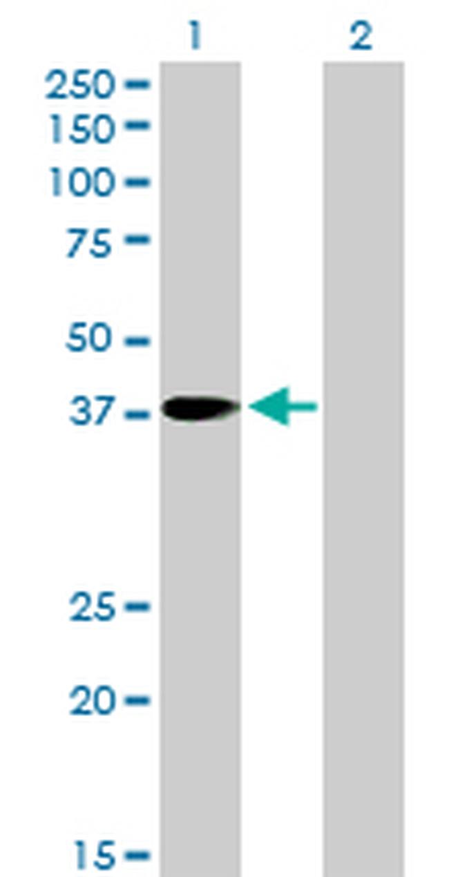 PNMA1 Antibody in Western Blot (WB)