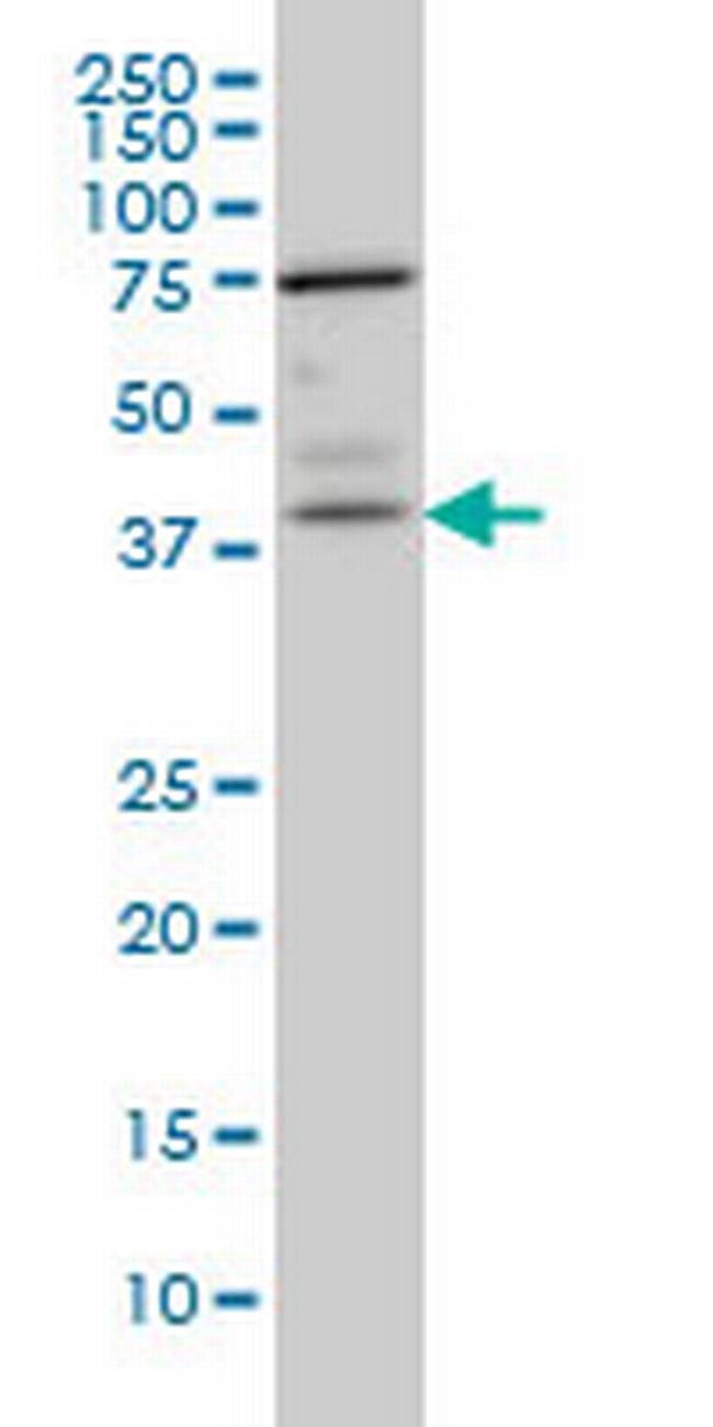 PNMA1 Antibody in Western Blot (WB)
