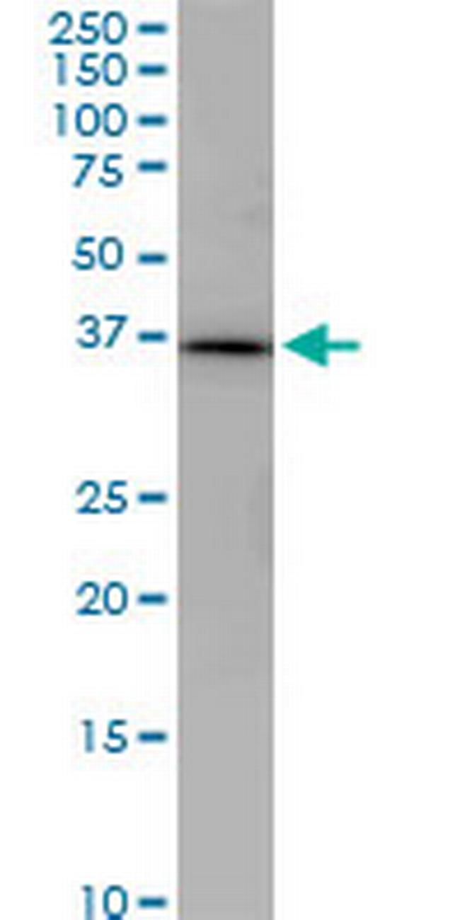 PNMA1 Antibody in Western Blot (WB)