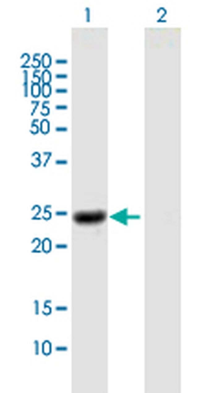 NOG Antibody in Western Blot (WB)