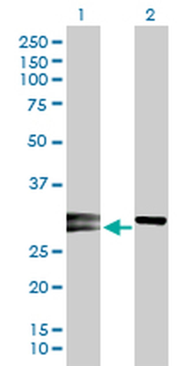 NOG Antibody in Western Blot (WB)