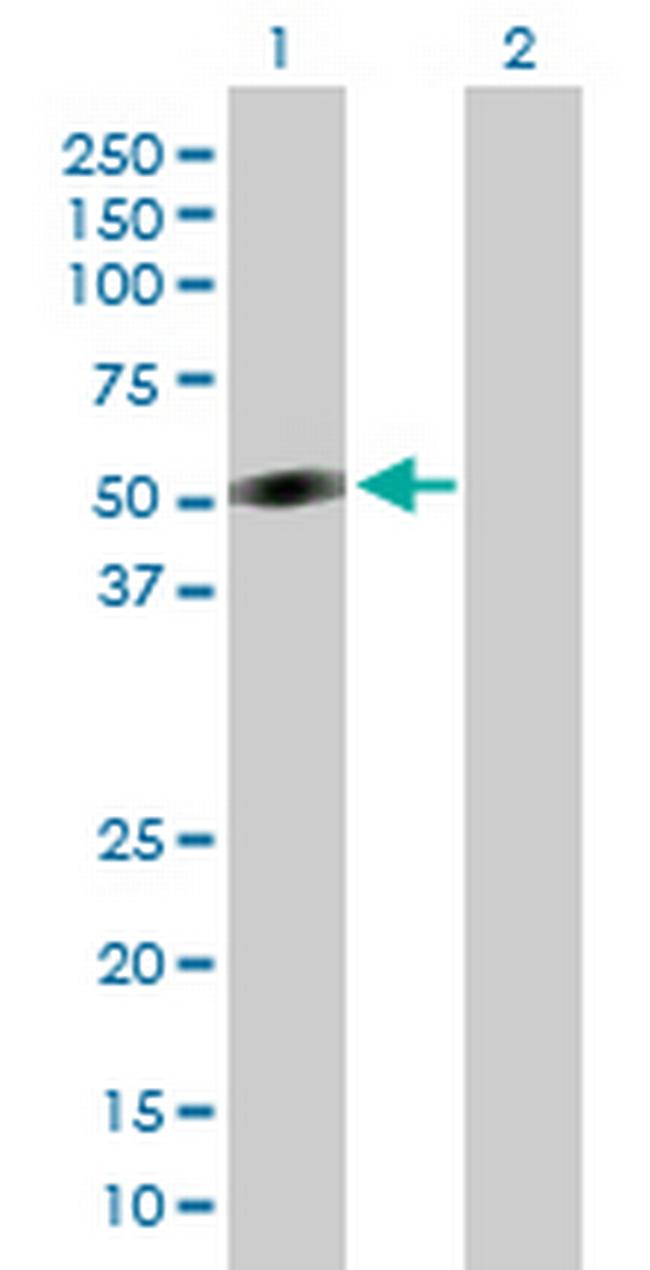 CRLF1 Antibody in Western Blot (WB)