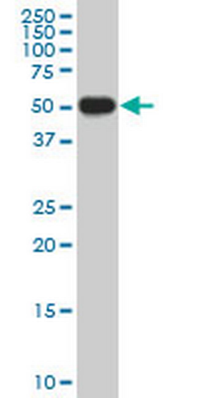 CRLF1 Antibody in Western Blot (WB)