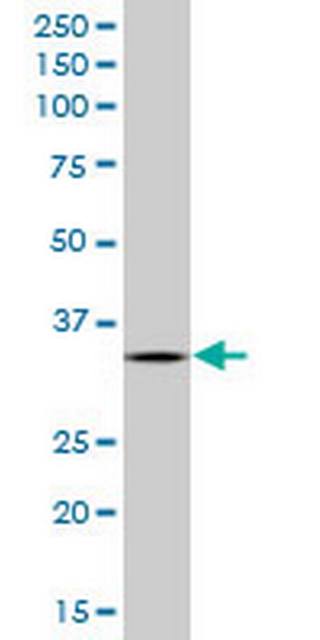 SCYE1 Antibody in Western Blot (WB)