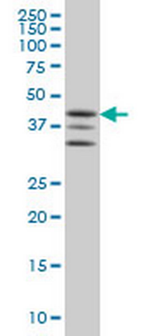 MAPKAPK2 Antibody in Western Blot (WB)