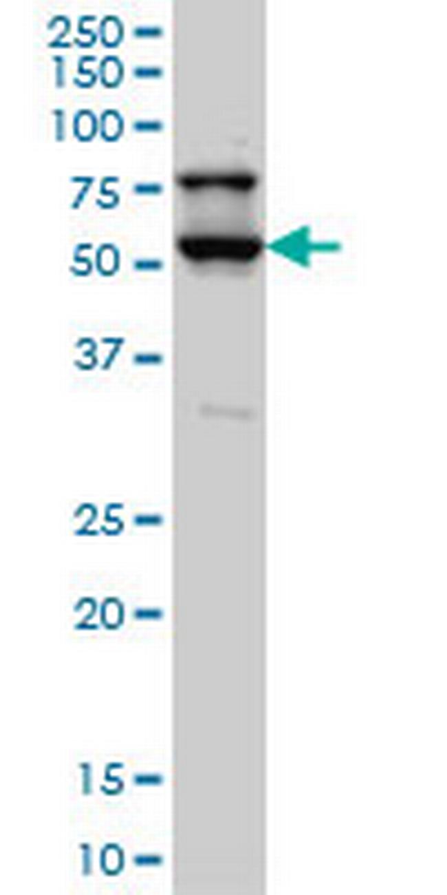 STK17A Antibody in Western Blot (WB)