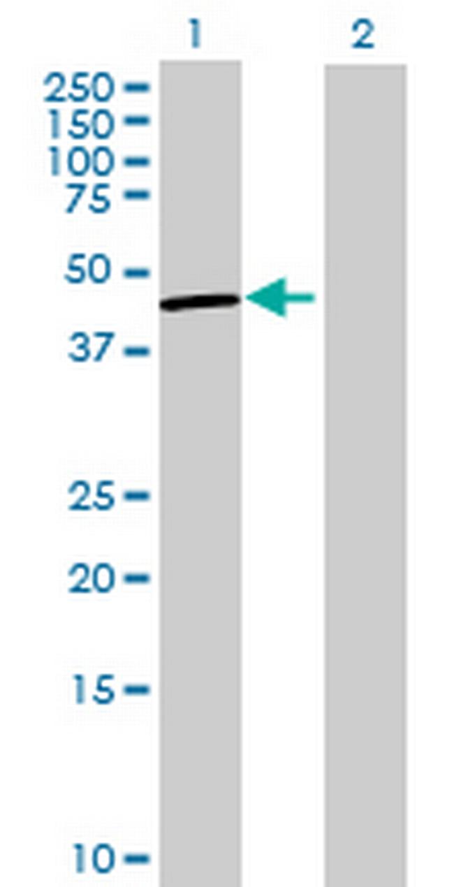 PSCD3 Antibody in Western Blot (WB)