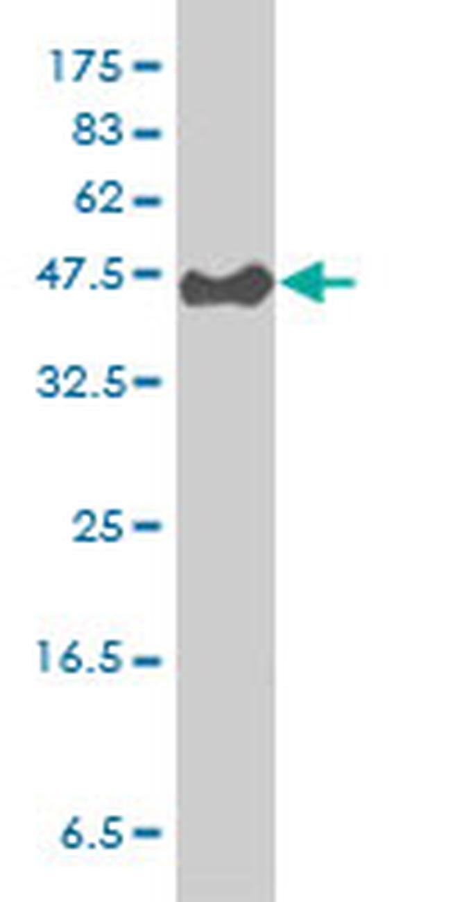 CYTH3 Antibody in Western Blot (WB)