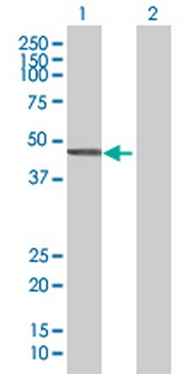 CYTH2 Antibody in Western Blot (WB)