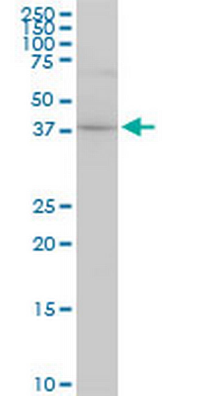 CYTH2 Antibody in Western Blot (WB)