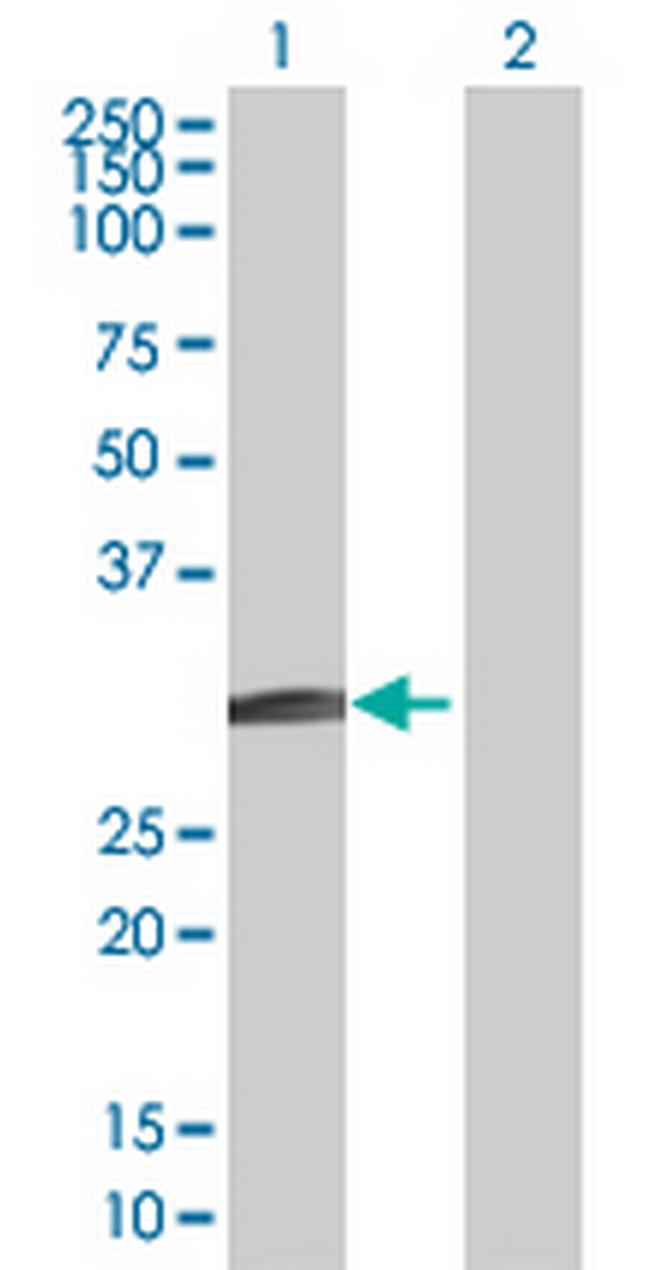 BCL7B Antibody in Western Blot (WB)