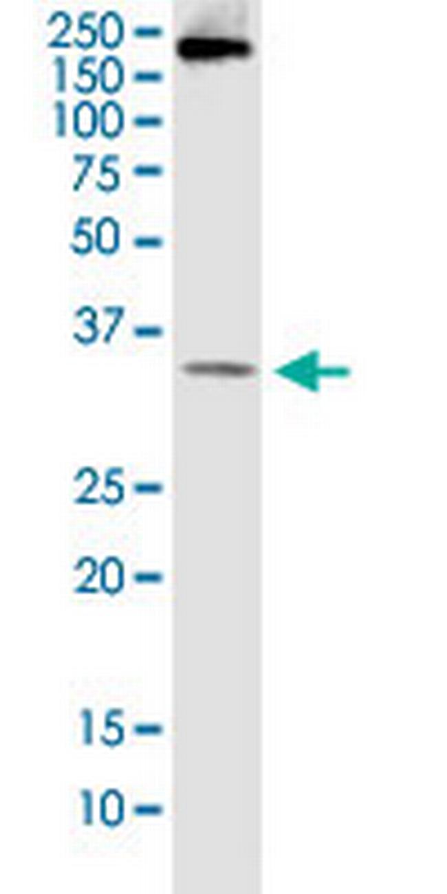 BCL7B Antibody in Western Blot (WB)