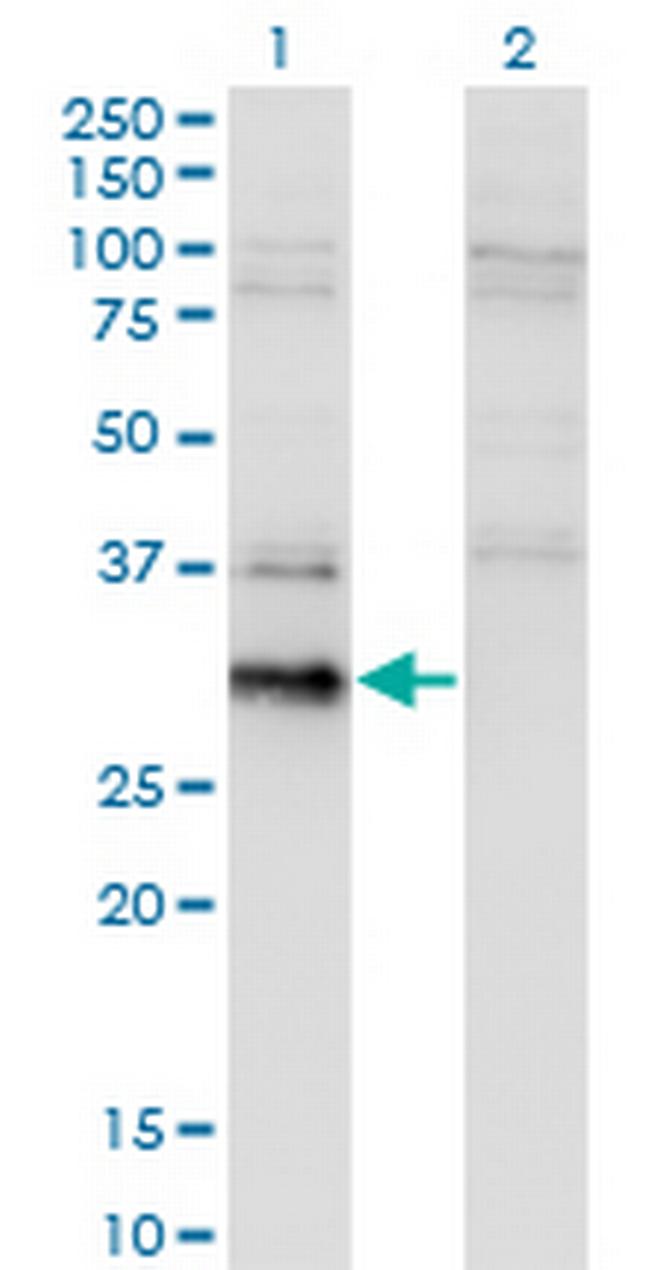 BCL7B Antibody in Western Blot (WB)
