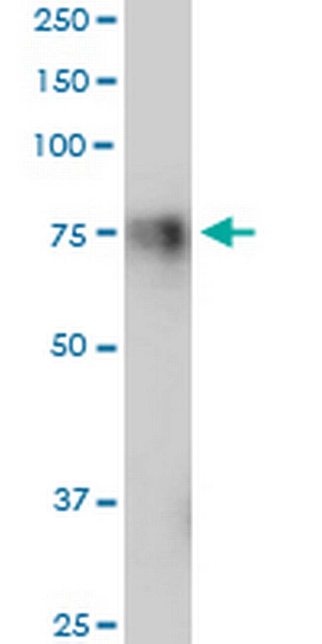 GPR56 Antibody in Western Blot (WB)