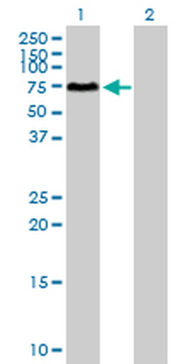 SOCS6 Antibody in Western Blot (WB)