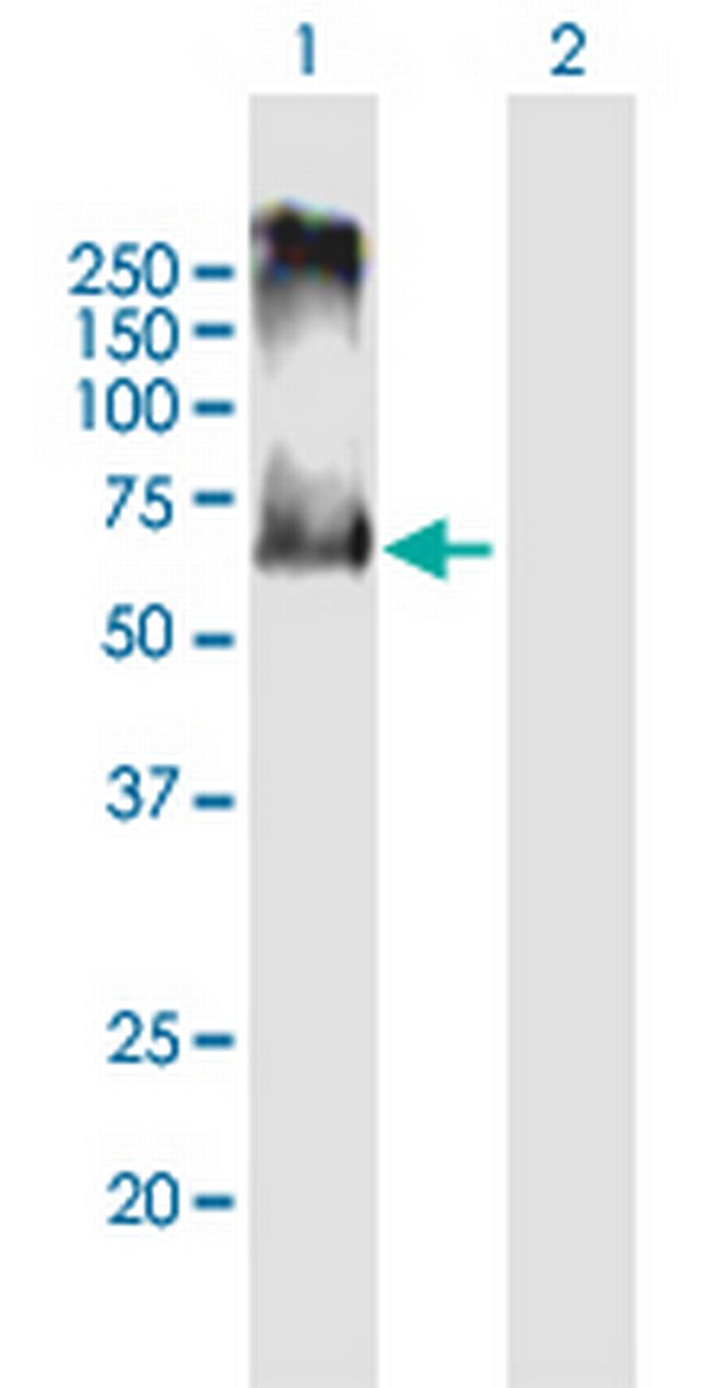 ACCN3 Antibody in Western Blot (WB)