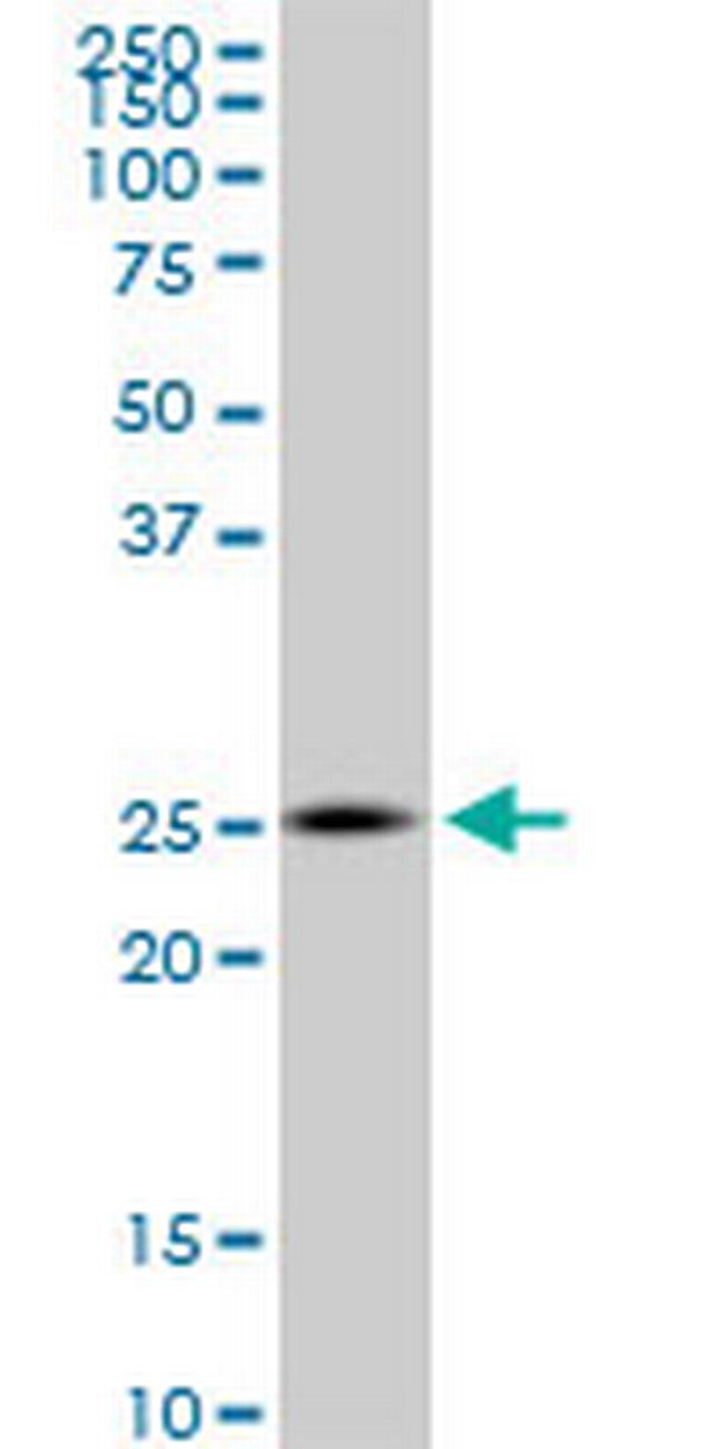 ZNHIT3 Antibody in Western Blot (WB)
