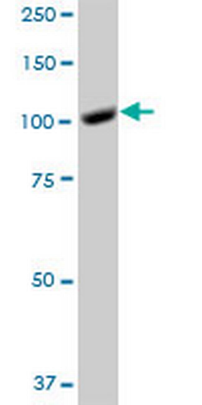 GTF3C3 Antibody in Western Blot (WB)