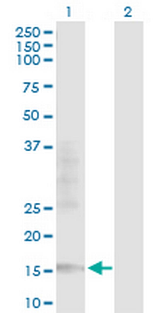 TCEAL1 Antibody in Western Blot (WB)