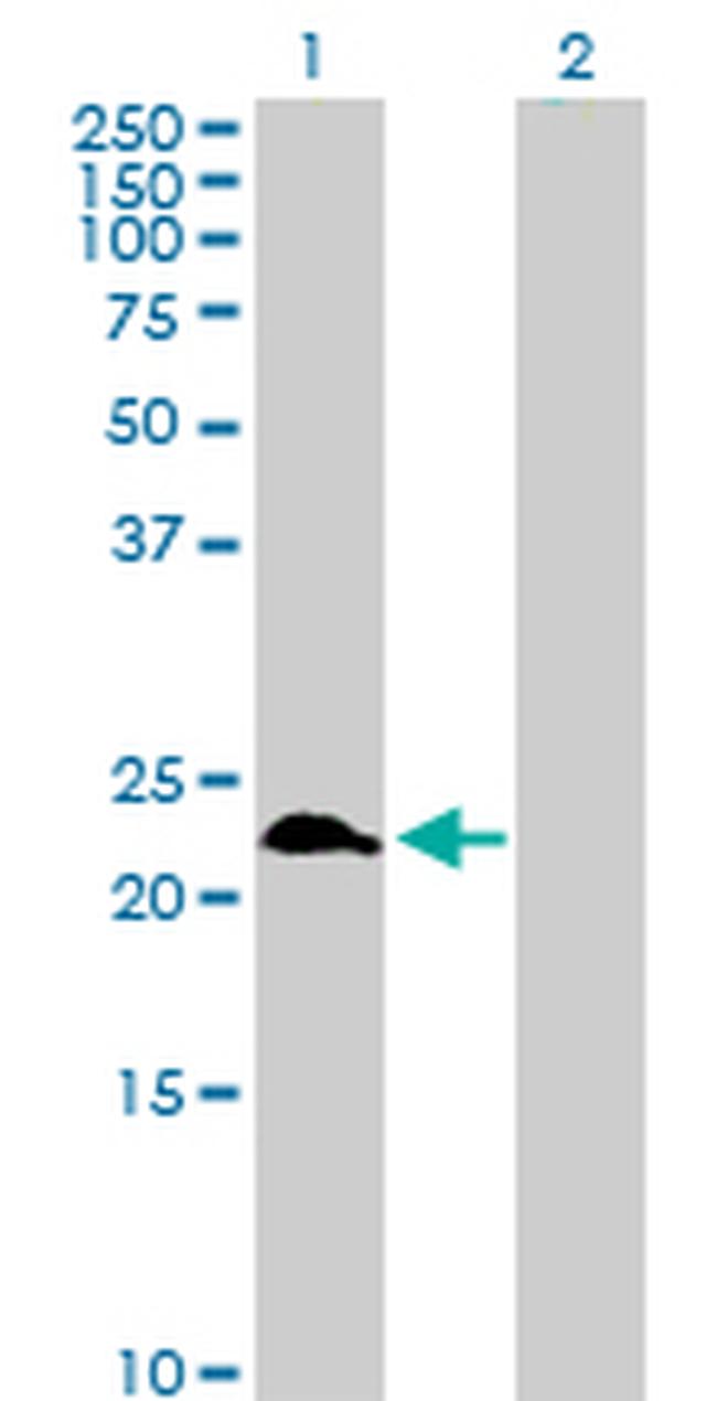 RAB9A Antibody in Western Blot (WB)