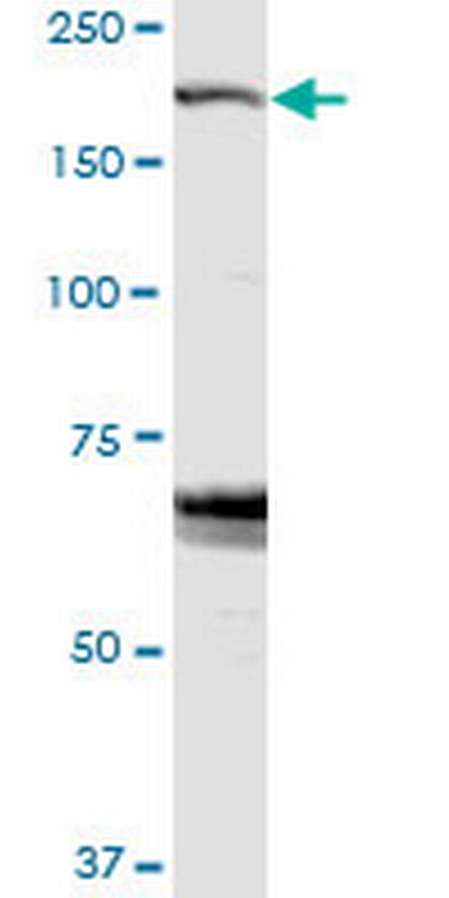 ZFYVE9 Antibody in Western Blot (WB)