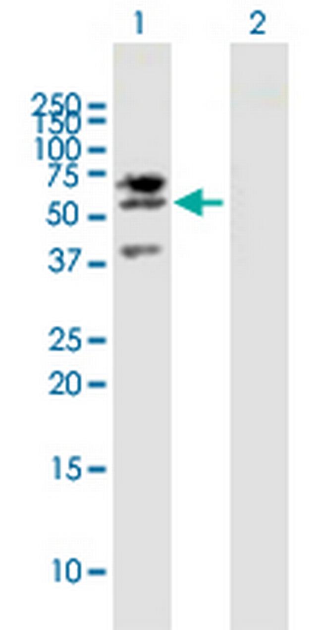 LIPG Antibody in Western Blot (WB)