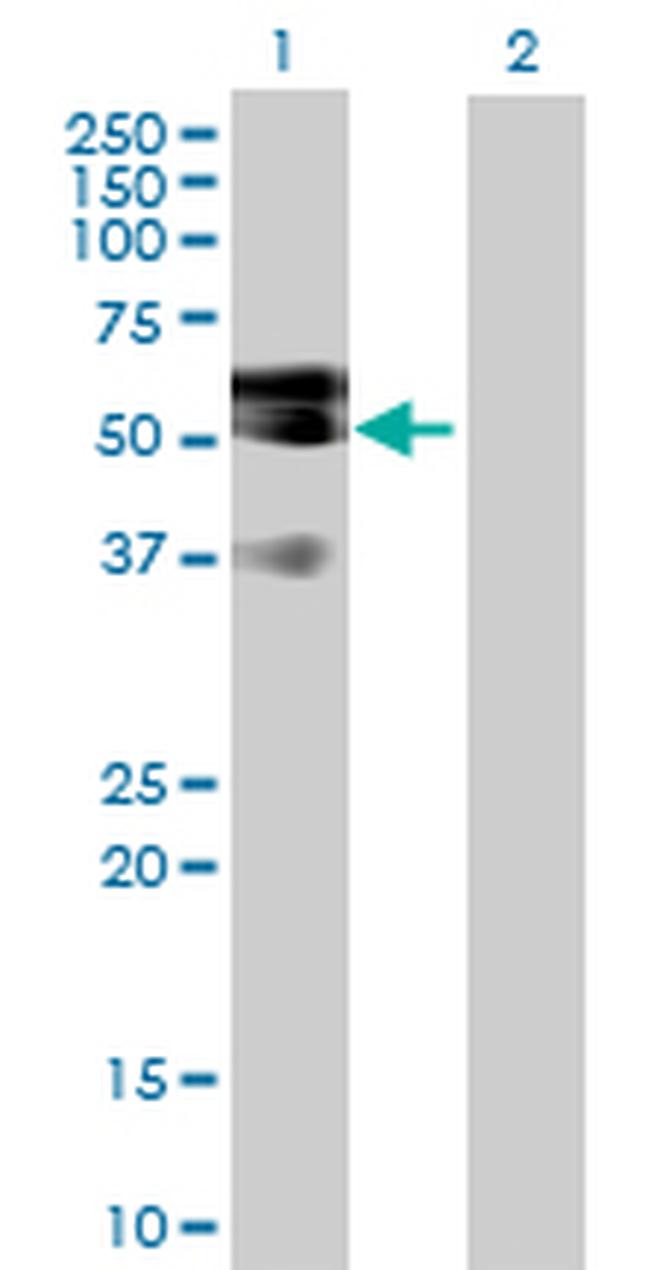 LIPG Antibody in Western Blot (WB)