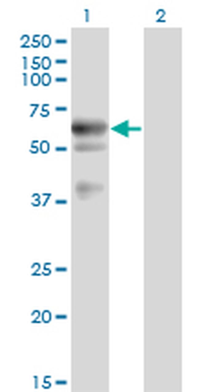 LIPG Antibody in Western Blot (WB)