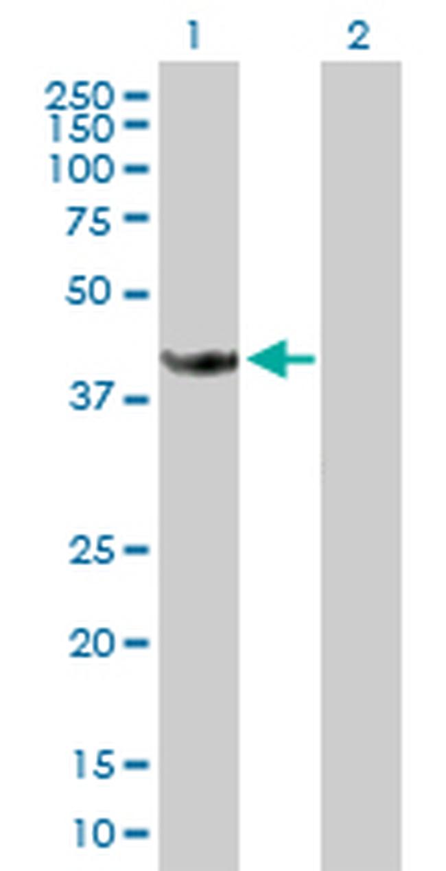STOML1 Antibody in Western Blot (WB)