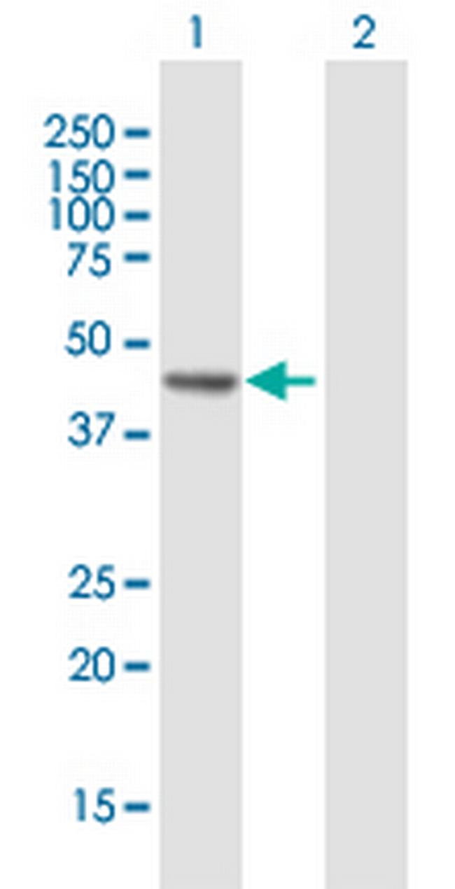 RECQL5 Antibody in Western Blot (WB)