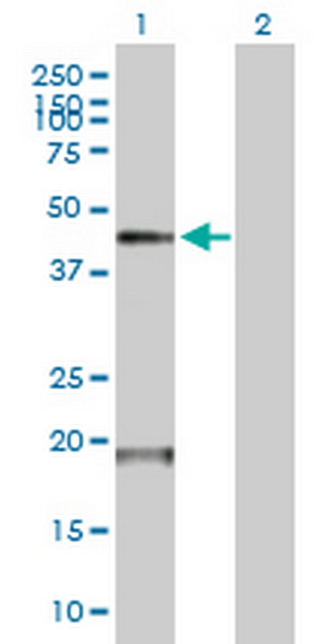 TMPRSS11D Antibody in Western Blot (WB)