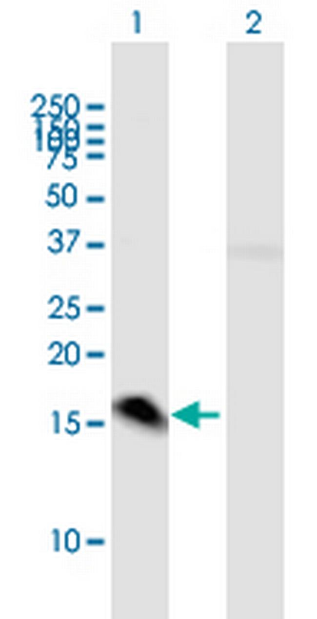 MED21 Antibody in Western Blot (WB)