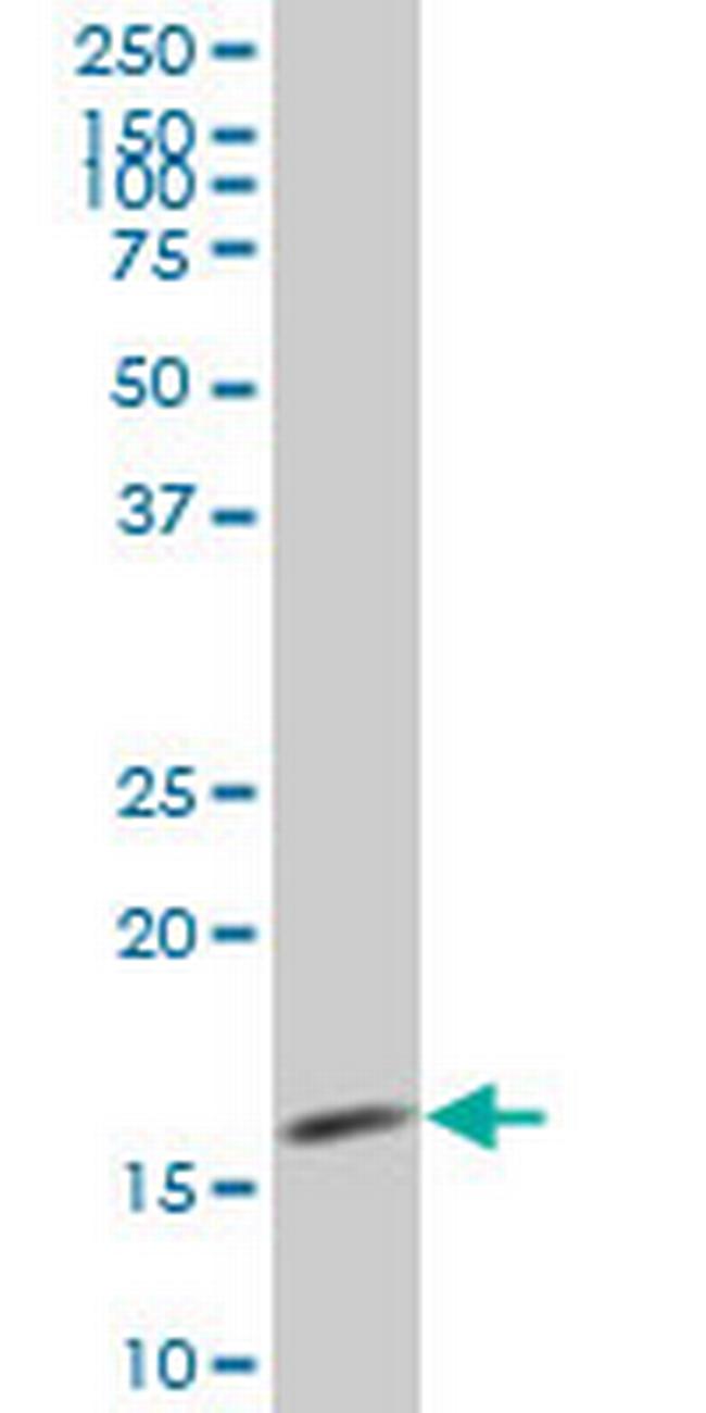 SURB7 Antibody in Western Blot (WB)