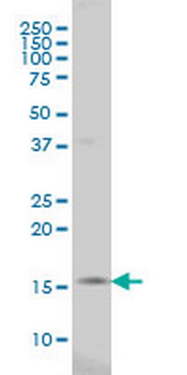 SURB7 Antibody in Western Blot (WB)
