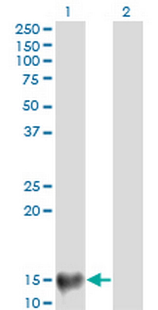 SURB7 Antibody in Western Blot (WB)