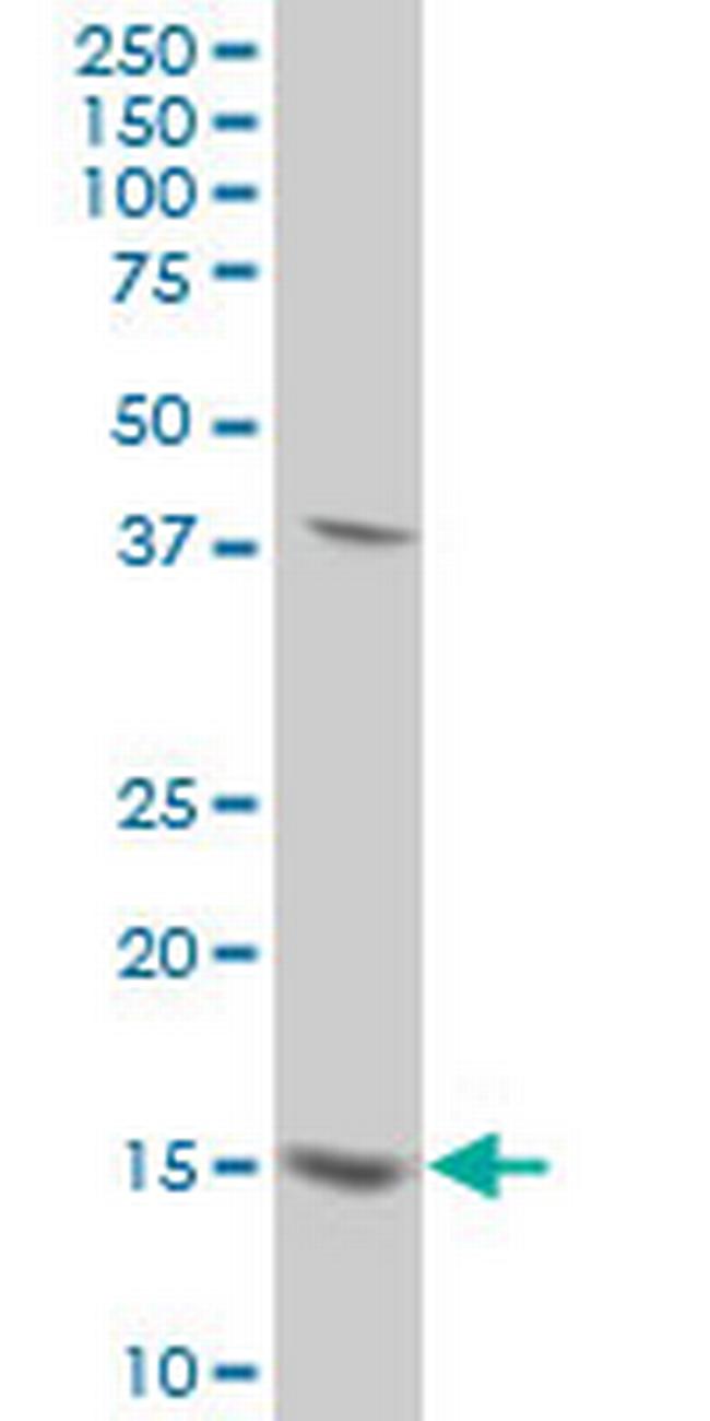 SURB7 Antibody in Western Blot (WB)