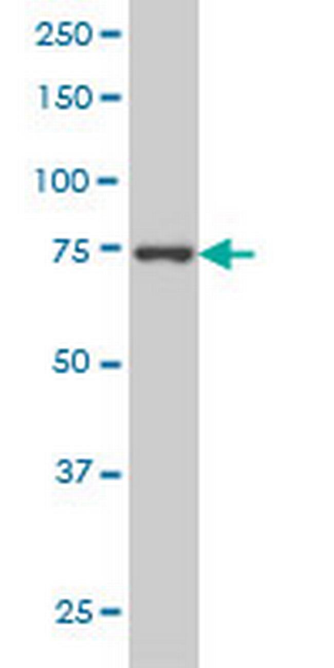 CRSP6 Antibody in Western Blot (WB)