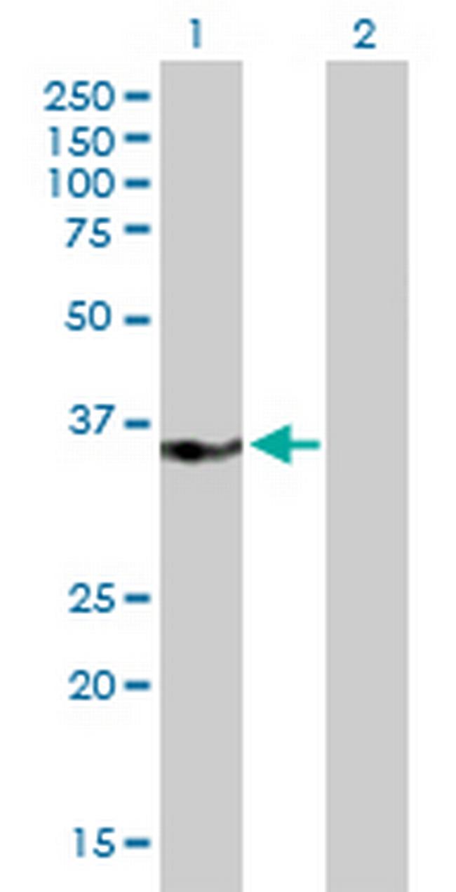 MED27 Antibody in Western Blot (WB)