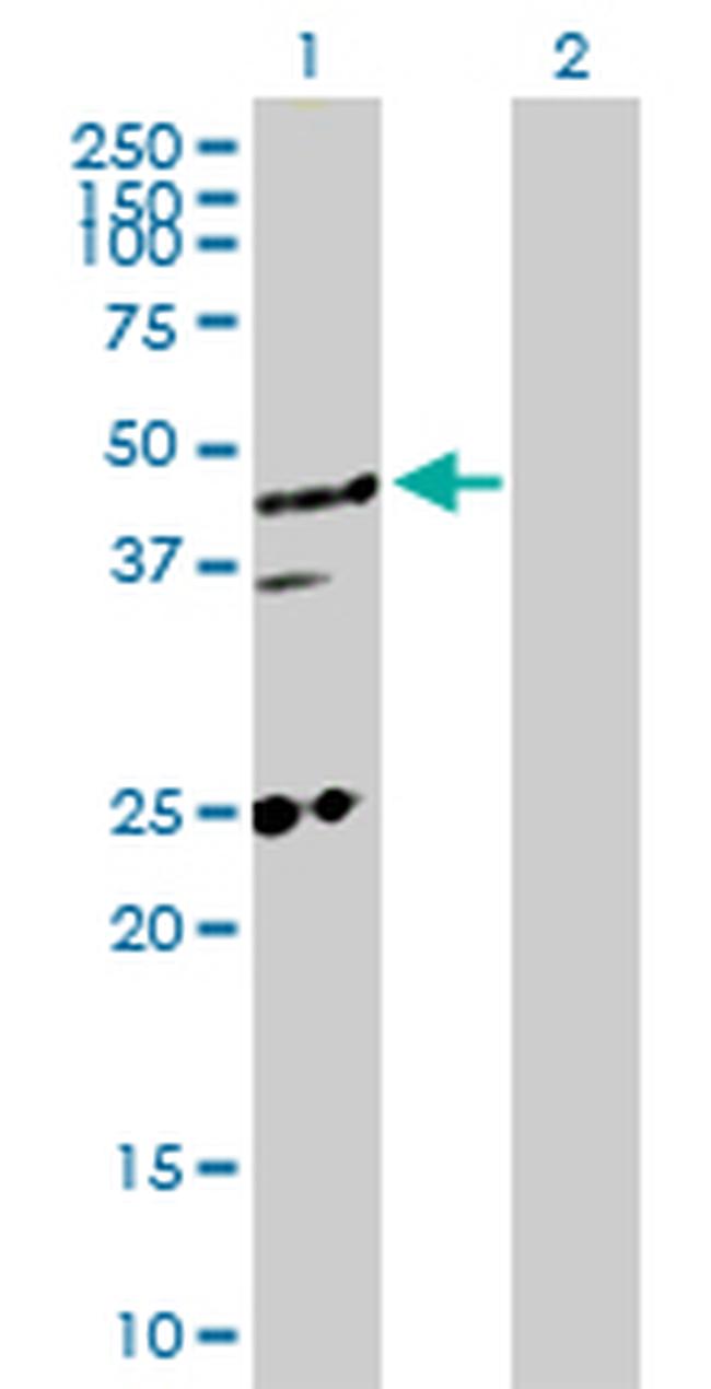 MED27 Antibody in Western Blot (WB)