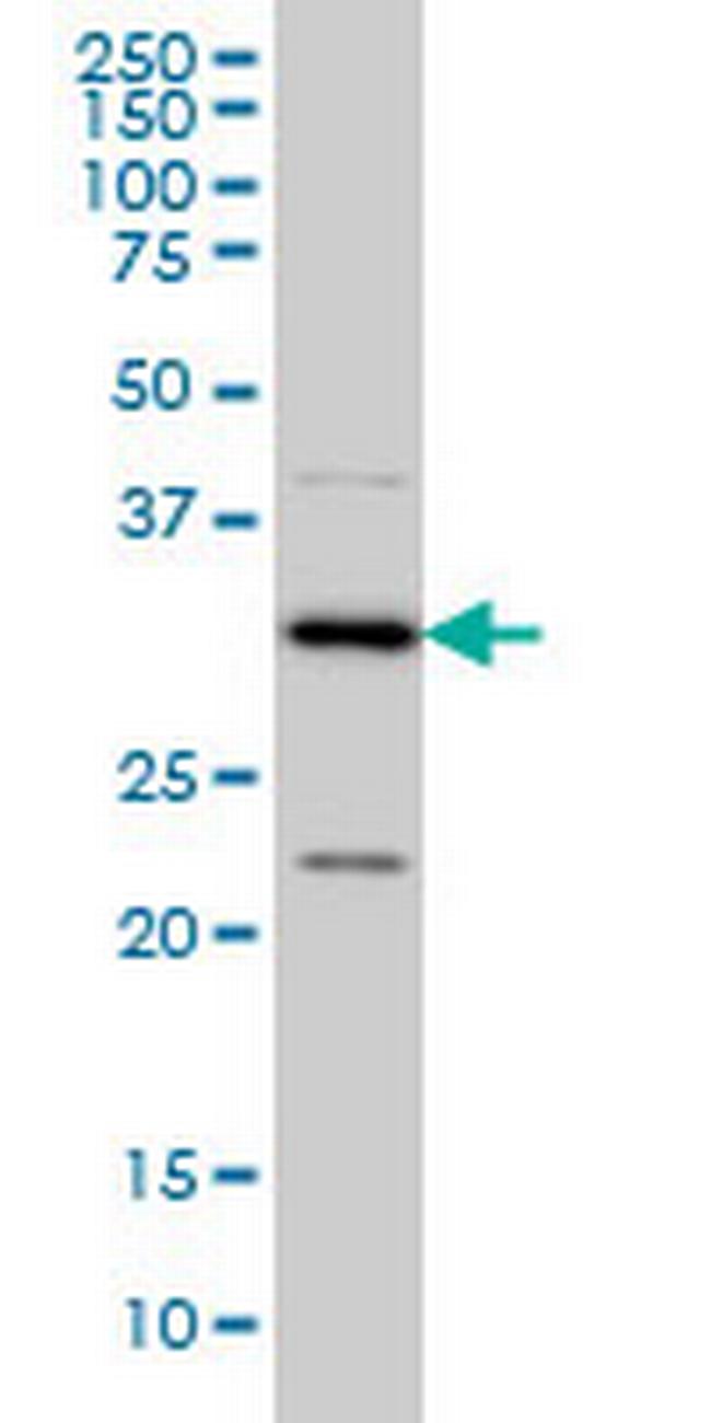 CRSP8 Antibody in Western Blot (WB)
