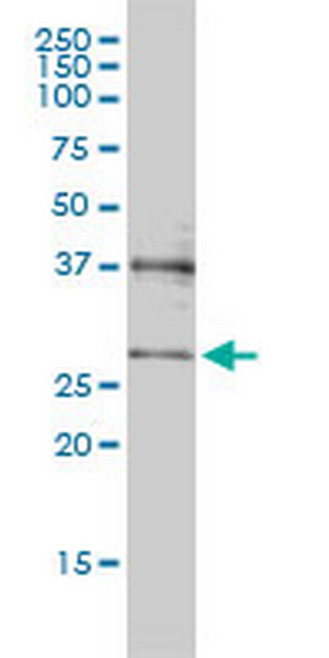 CRSP9 Antibody in Western Blot (WB)