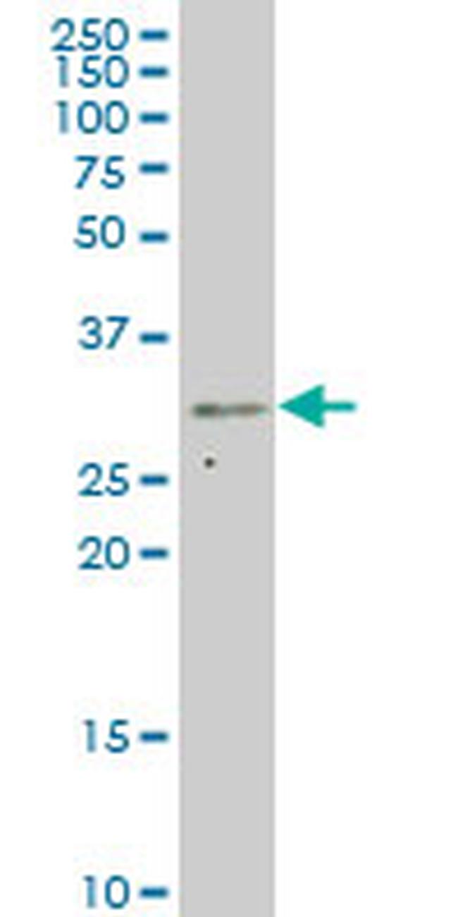 CRSP9 Antibody in Western Blot (WB)