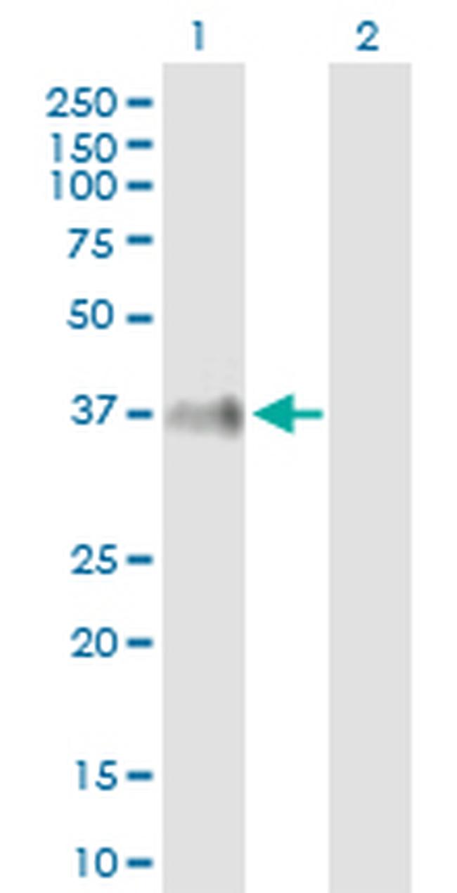 ITM2B Antibody in Western Blot (WB)