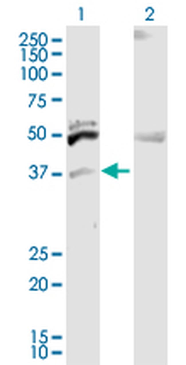 ITM2B Antibody in Western Blot (WB)