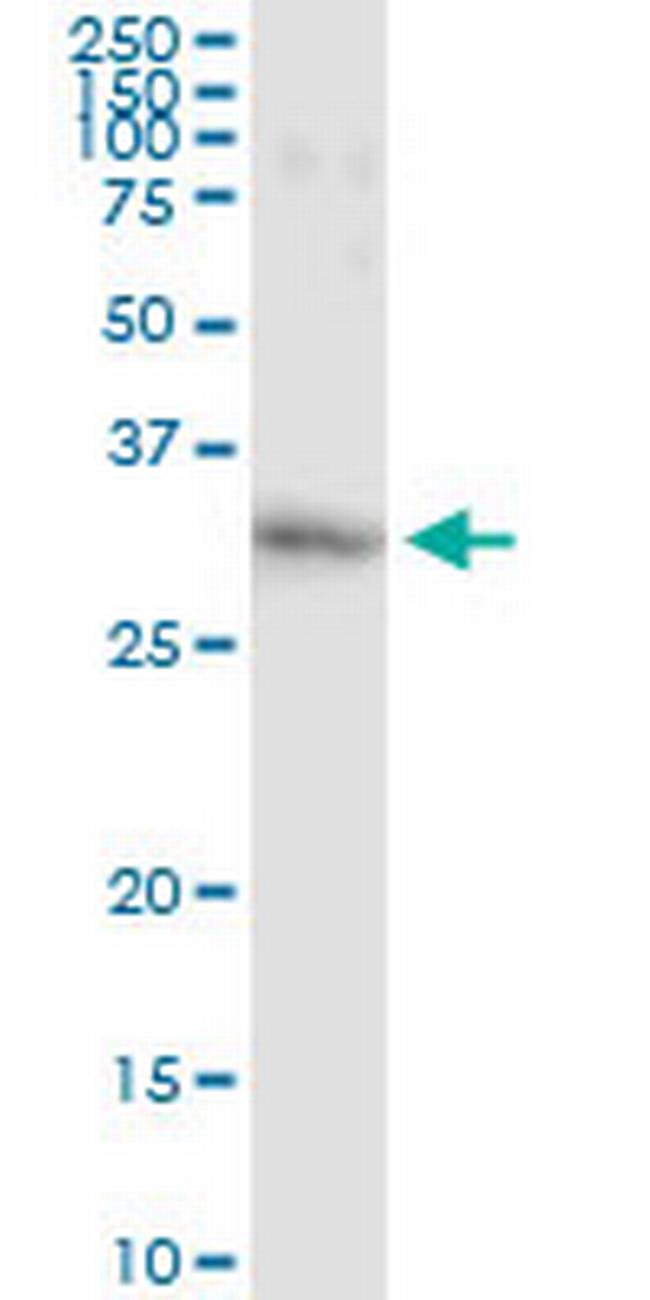 GSTO1 Antibody in Immunoprecipitation (IP)