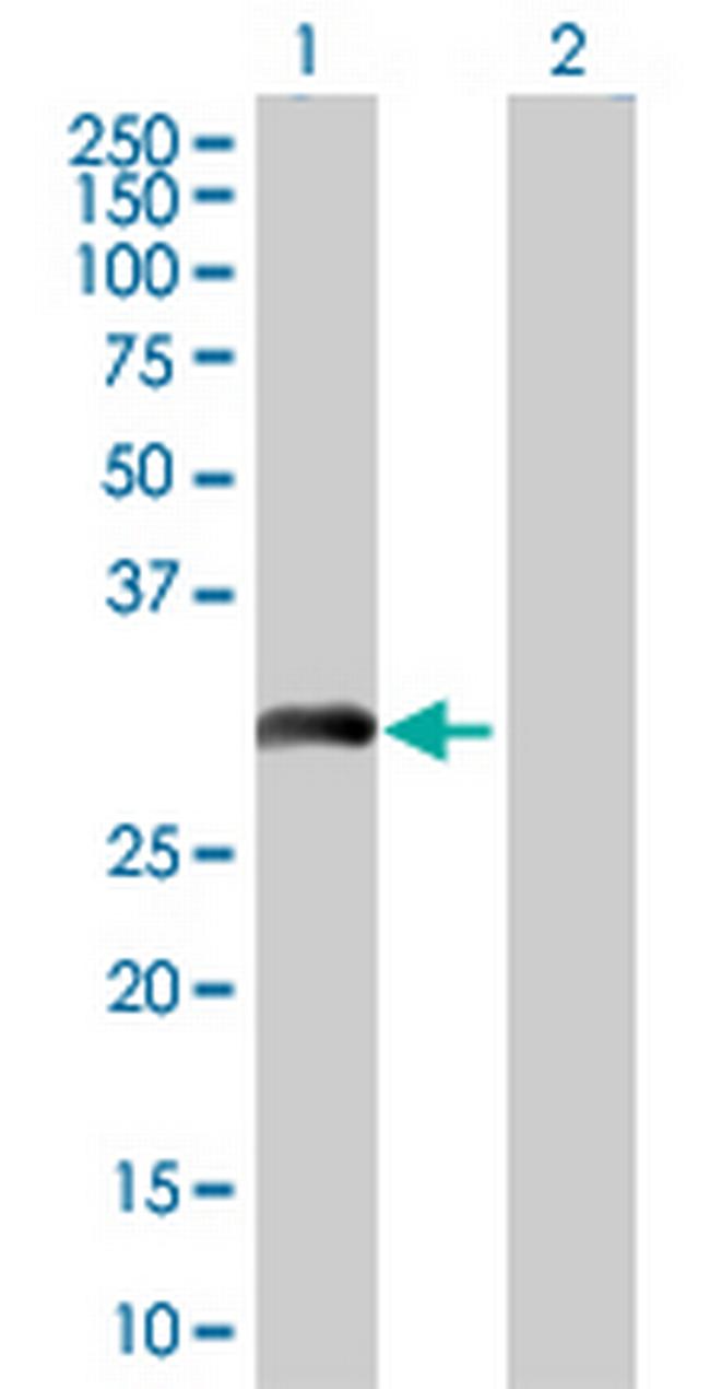 FHL5 Antibody in Western Blot (WB)