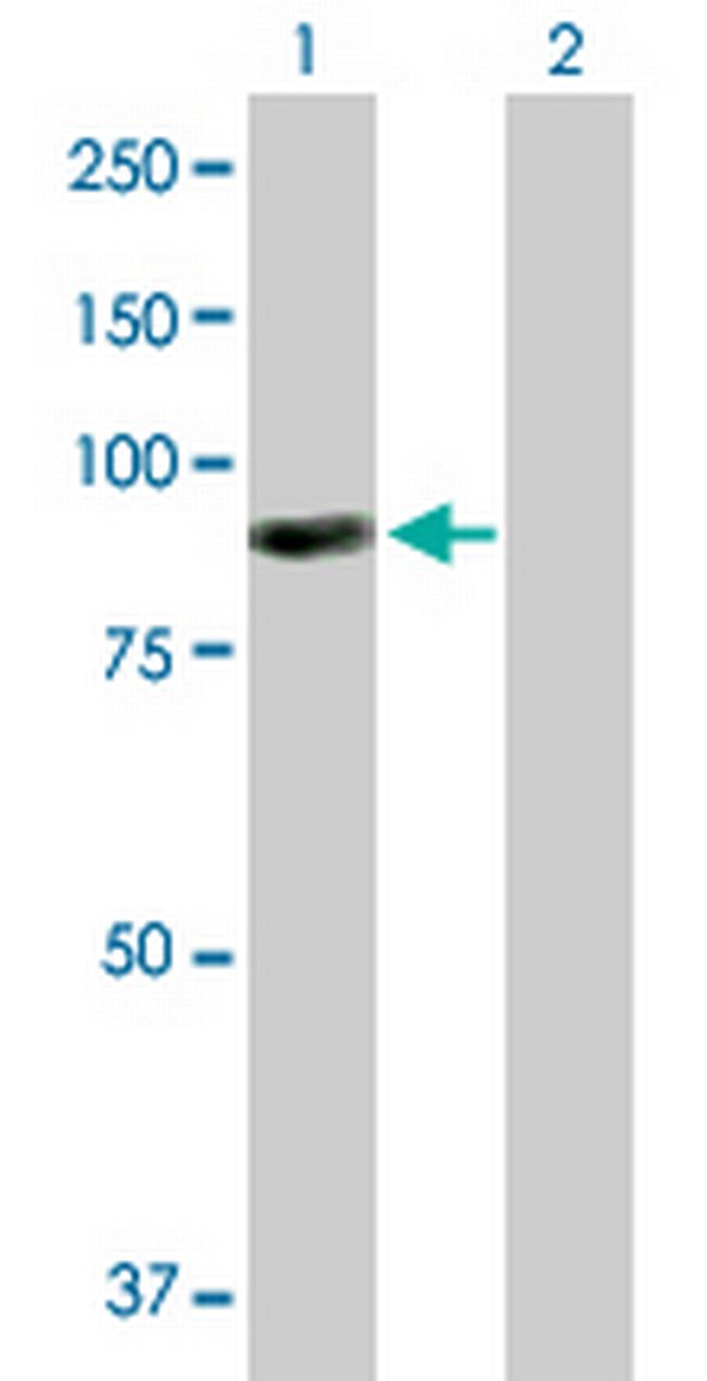 ARHGEF6 Antibody in Western Blot (WB)