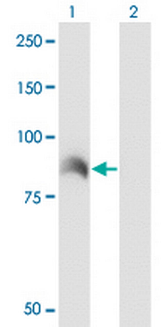 ARHGEF6 Antibody in Western Blot (WB)