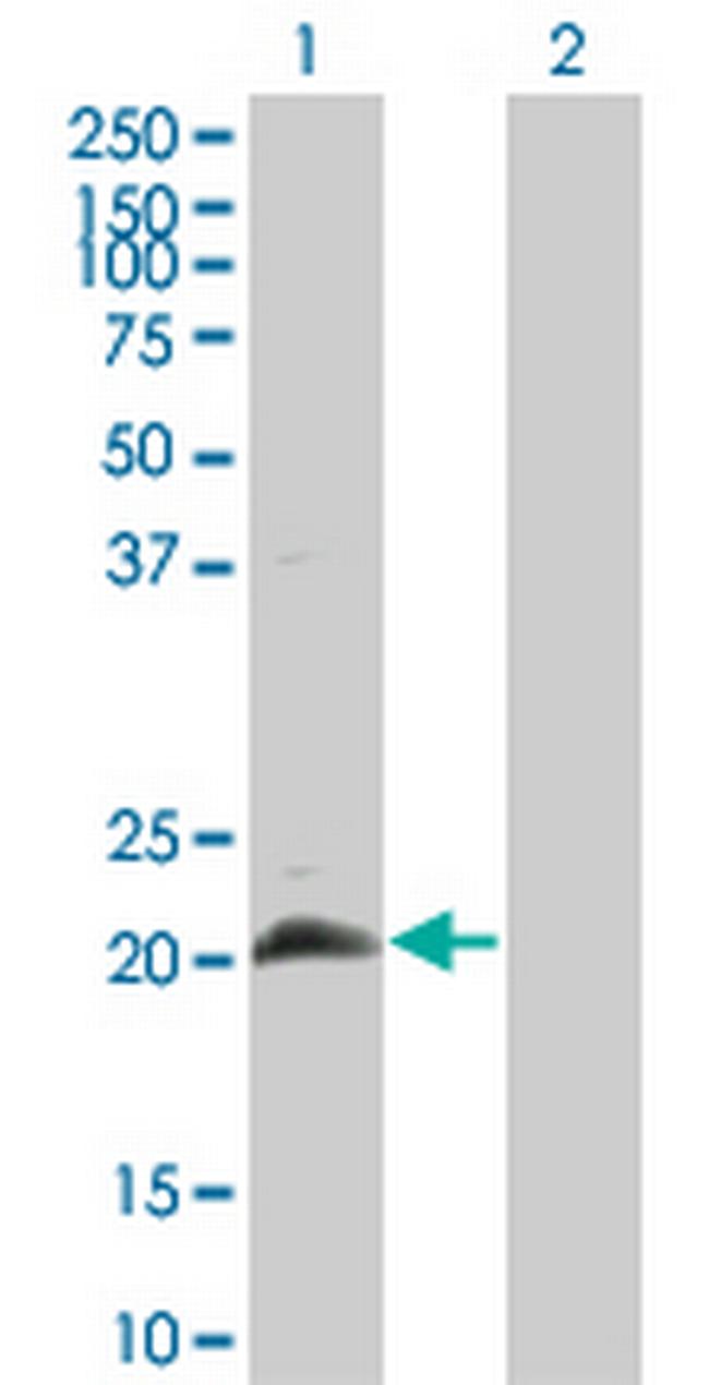 HAND2 Antibody in Western Blot (WB)