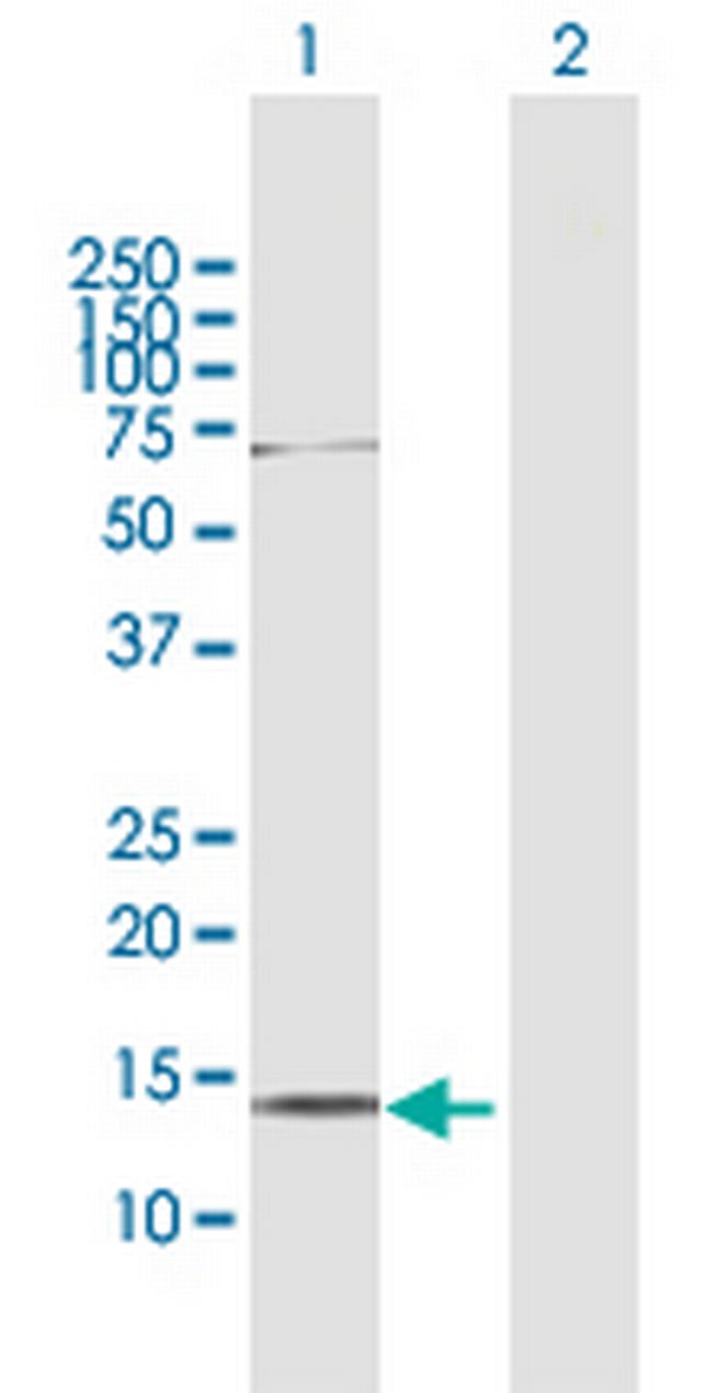 AKAP7 Antibody in Western Blot (WB)